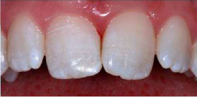 After Image